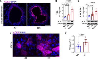 Hypercapnia increases ACE2 expression and pseudo-SARS-CoV-2 entry in bronchial epithelial cells by augmenting cellular cholesterol